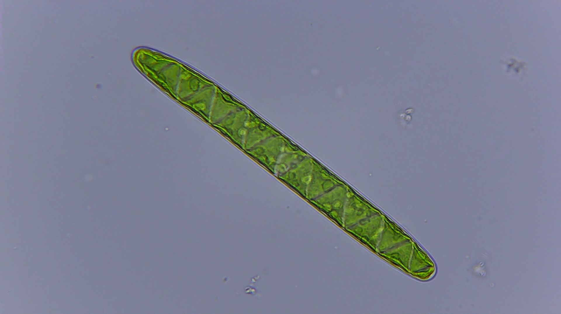 Spirotaenia Condensata