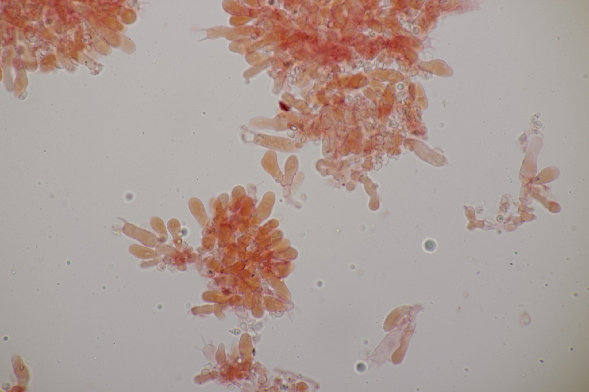 Trechispora Cohaerens