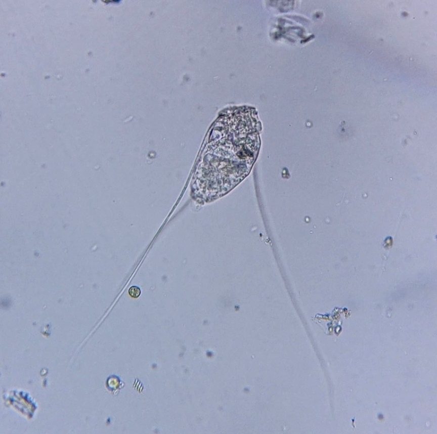 Filinia Terminalis