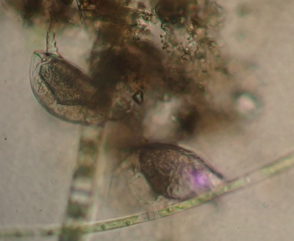 Lepadella Triptera