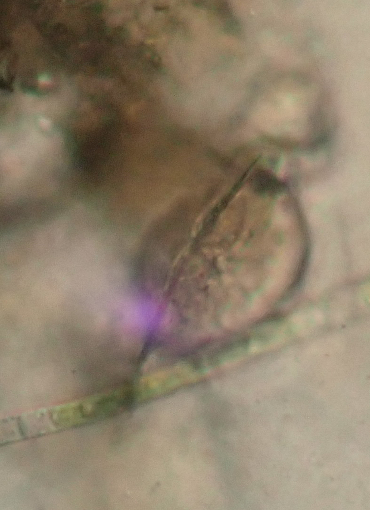 Lepadella Triptera