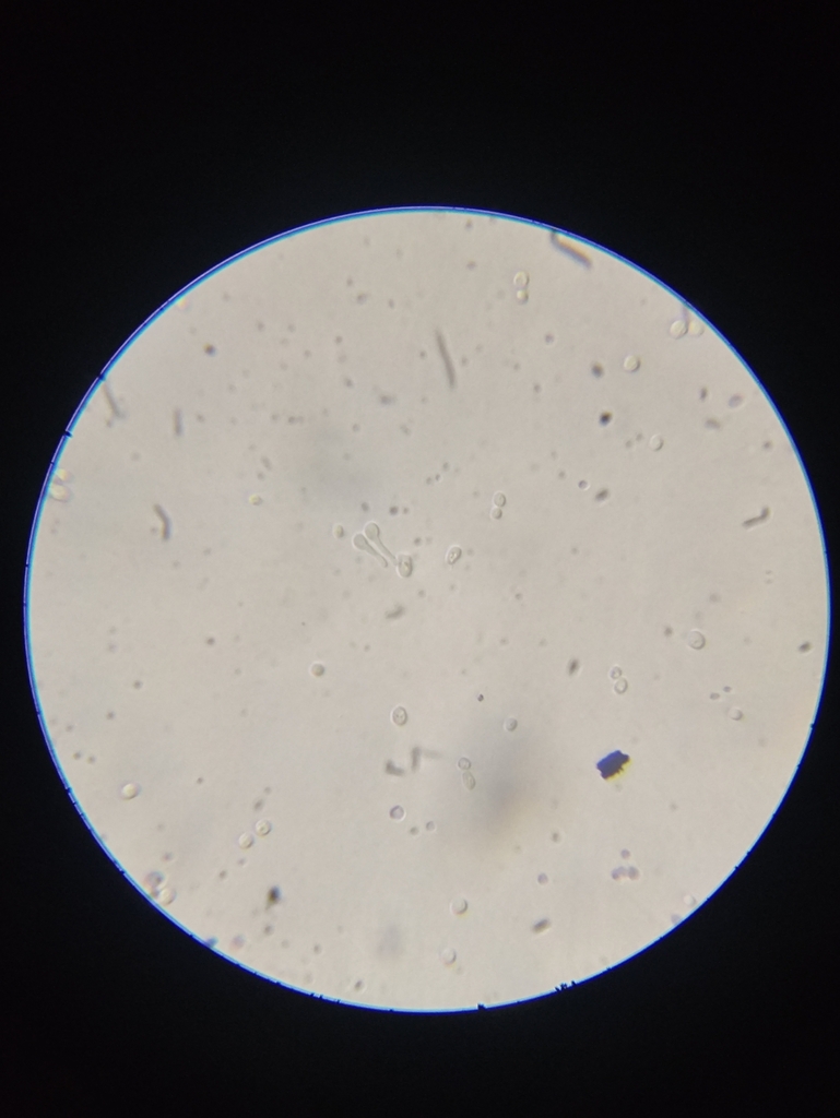 Candida Yeast